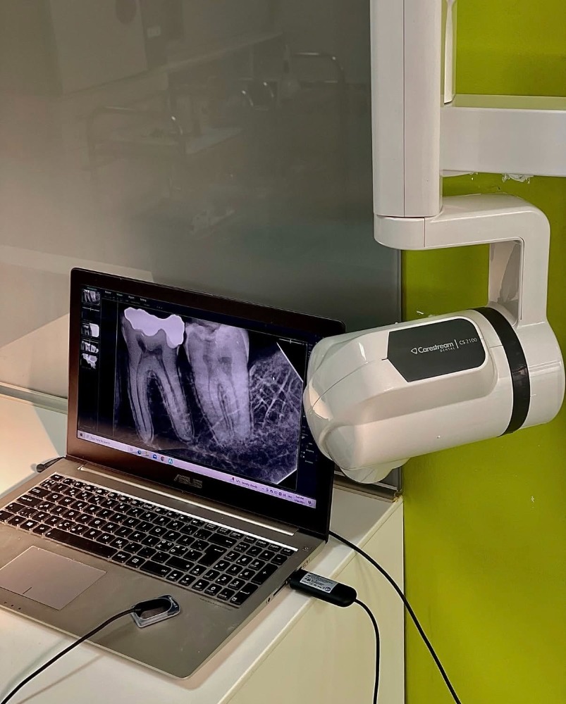 Digital radiography